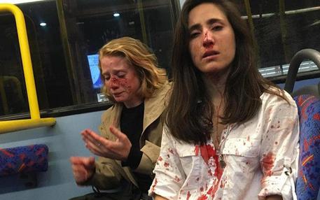 Coppia lesbica picchiata sul bus a Londra da quattro teenager: per la May 'ripugnante'