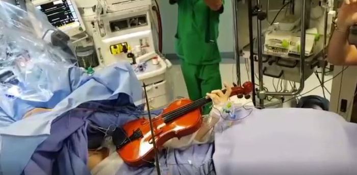 Operata al cervello a Taranto mentre suona il violino in sala operatoria