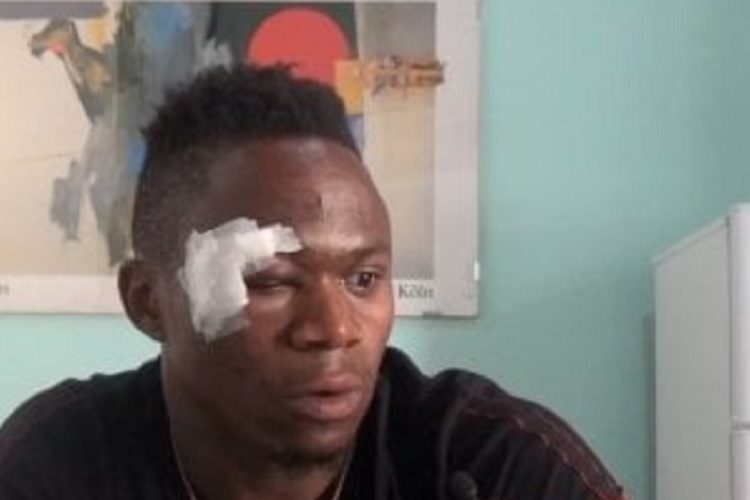 Massacrò nigeriano di botte a Bagheria: un anno e 8 mesi dal tribunale